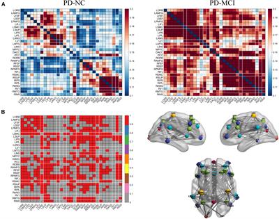 Identifying Mild Cognitive Impairment in Parkinson’s Disease With Electroencephalogram Functional Connectivity